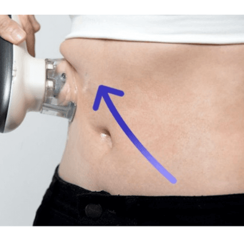 [MEDITHERAPY] SOKSAL Zero &amp;Waterbomb Body Line Lifting Therapy Liposuction Massage Device &amp; SOKSAL Water Bomb 6